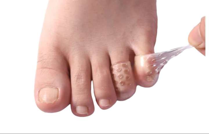 SILICONE TOE/FINGER PROTECTORS (10 Pcs)