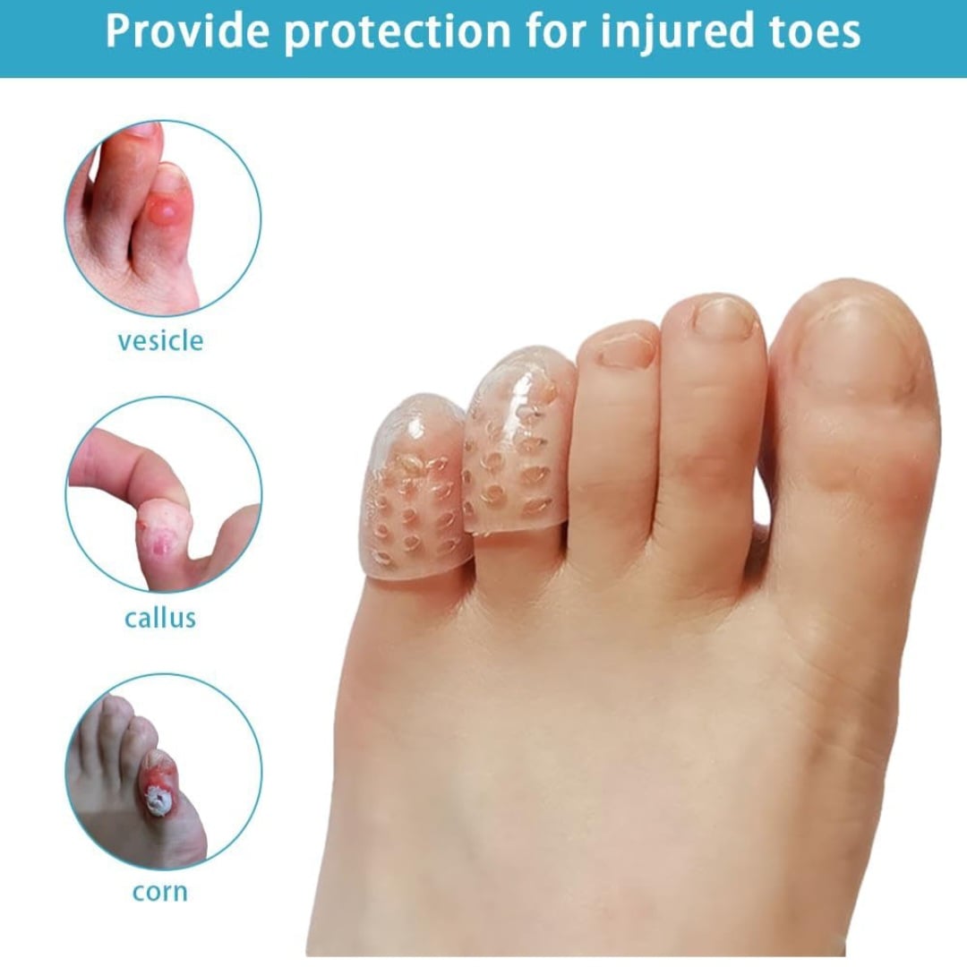 SILICONE TOE/FINGER PROTECTORS (10 Pcs)